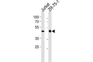 Western Blotting (WB) image for anti-ECSIT (ECSIT) antibody (ABIN2998295) (ECSIT Antikörper)