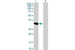 Western Blot analysis of SULT1C2 expression in transfected 293T cell line by SULT1C2 MaxPab polyclonal antibody. (SULT1C2 Antikörper  (AA 1-296))