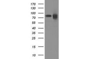 HEK293T cells were transfected with the pCMV6-ENTRY control (Left lane) or pCMV6-ENTRY PRKCE (Right lane) cDNA for 48 hrs and lysed. (PKC epsilon Antikörper)