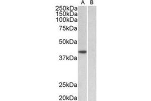 AP31930PU-N TBP antibody staining of HeLa nuclear (A) and cytosolic (B) lysates at 1 µg/ml (35µg protein in RIPA buffer). (TBP Antikörper  (Internal Region))