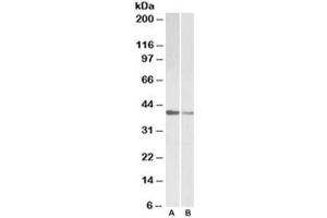 Western blot testing of human [A] and mouse [B] heart lysate with TNNT2 antibody at 0. (Cardiac Troponin T2 Antikörper)