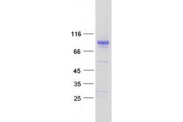 MFRP Protein (Myc-DYKDDDDK Tag)