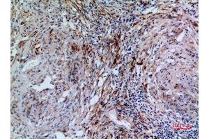 Immunohistochemistry (IHC) analysis of paraffin-embedded Human Lung, antibody was diluted at 1:100. (17beta-HSD4 (N-Term) Antikörper)