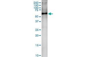 Immunoprecipitation of HDAC1 transfected lysate using anti-HDAC1 MaxPab rabbit polyclonal antibody and Protein A Magnetic Bead , and immunoblotted with HDAC1 MaxPab mouse polyclonal antibody (B01) . (HDAC1 Antikörper  (AA 1-482))