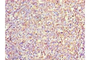 Immunohistochemistry of paraffin-embedded human tonsil tissue using ABIN7156730 at dilution of 1:100 (IL1A Antikörper  (AA 1-152))