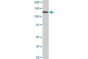 CAND1 monoclonal antibody (M03), clone 2D7. (CAND1 Antikörper  (AA 1-100))