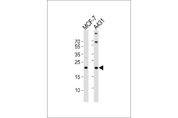 TIMM23 Antikörper  (C-Term)