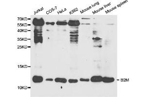 Western blot analysis of extracts of various cell lines, using B2M antibody (ABIN5970743) at 1/1000 dilution. (beta-2 Microglobulin Antikörper)
