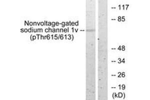 Western blot analysis of extracts from HeLa cells, using Nonvoltage-gated Sodium Channel 1 (Phospho-Thr615) Antibody. (Nonvoltage-Gated Sodium Channel 1 (AA 581-630), (pThr615) Antikörper)