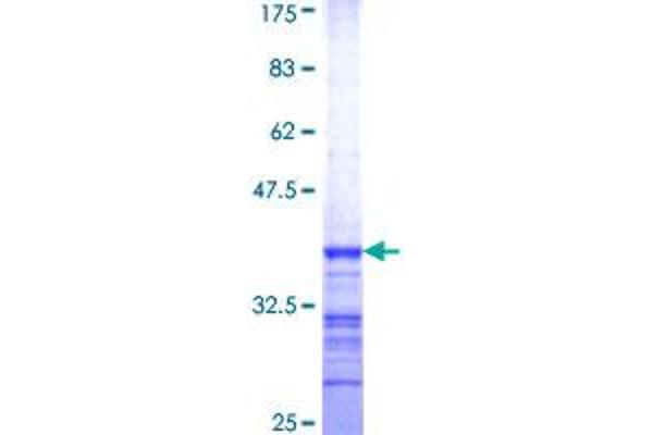 MUS81 Protein (AA 452-549) (GST tag)