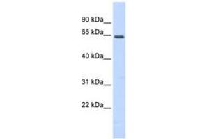 Image no. 1 for anti-Myocyte Enhancer Factor 2A (MEF2A) (N-Term) antibody (ABIN6742787) (MEF2A Antikörper  (N-Term))