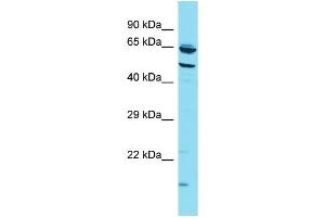 Host: Rabbit Target Name: CCZ1B Sample Type: HT1080 Whole Cell lysates Antibody Dilution: 1. (CCZ1B Antikörper  (N-Term))
