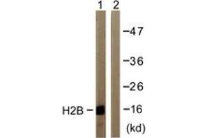 Western blot analysis of extracts from COS7 cells, treated with TSA 400nM 24h, using Histone H2B (Ab-12) Antibody. (Histone H2B Antikörper  (AA 10-59))