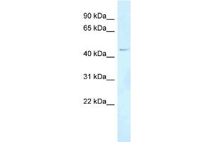 WB Suggested Anti-FOXN2 Antibody Titration: 1. (FOXN2 Antikörper  (Middle Region))