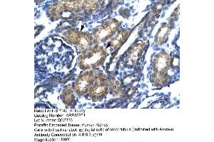Immunohistochemistry (IHC) image for anti-SP140 Nuclear Body Protein (SP140) (N-Term) antibody (ABIN182690) (SP140 Antikörper  (N-Term))