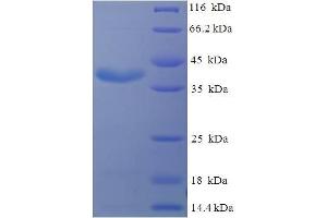 SDS-PAGE (SDS) image for Prolactin (PRL) (AA 31-229) protein (His-SUMO Tag) (ABIN5710149) (Prolactin Protein (PRL) (AA 31-229) (His-SUMO Tag))