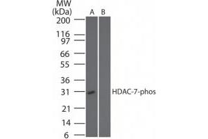 Image no. 1 for anti-Histone Deacetylase 7 (HDAC7) (pSer318) antibody (ABIN225622) (HDAC7 Antikörper  (pSer318))