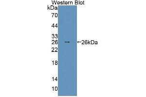 Detection of Recombinant ABCD2, Mouse using Polyclonal Antibody to ATP Binding Cassette Transporter D2 (ABCD2) (Abcd2 Antikörper  (AA 501-695))
