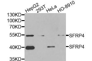 Western blot analysis of extracts of various cell lines, using SFRP4 antibody (ABIN5973810) at 1/1000 dilution. (SFRP4 Antikörper)