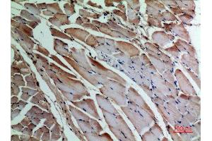 Immunohistochemistry (IHC) analysis of paraffin-embedded Rat Muscle, antibody was diluted at 1:100. (alpha-SMA (C-Term) Antikörper)