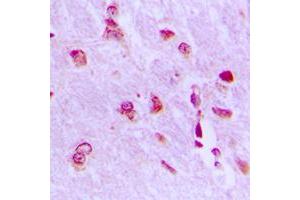 Immunohistochemical analysis of ARHGAP18 staining in human brain formalin fixed paraffin embedded tissue section. (ARHGAP18 Antikörper  (C-Term))