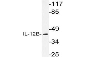 Western blot (WB) analysis of IL-12B antibody in extracts from K562 cells. (IL12B Antikörper)