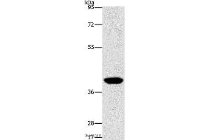 Western blot analysis of Human lymphoma tissue, using AGXT2L2 Polyclonal Antibody at dilution of 1:500 (AGXT2L2 Antikörper)