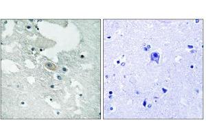 Immunohistochemistry analysis of paraffin-embedded human brain tissue using BLNK (Phospho-Tyr84) antibody. (B-Cell Linker Antikörper  (pTyr84))