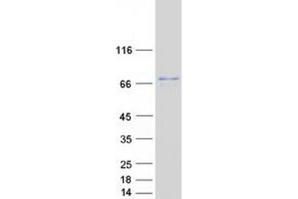 NDUFV3 Protein (Transcript Variant 1) (Myc-DYKDDDDK Tag)