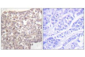 Immunohistochemistry (IHC) image for anti-Tubulin, gamma 1 (TUBG1) (C-Term) antibody (ABIN1848869) (TUBG1 Antikörper  (C-Term))