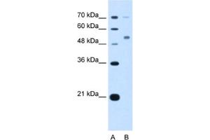 Western Blotting (WB) image for anti-Cerebellar Degeneration-Related Protein 2, 62kDa (CDR2) antibody (ABIN2463409) (CDR2 Antikörper)
