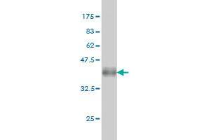 Western Blot detection against Immunogen (37. (FGFR2 Antikörper  (AA 621-723))