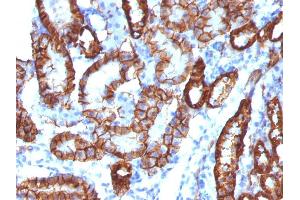 Immunohistochemistry (IHC) image for anti-Cadherin-16 (CDH16) antibody (ABIN6939024)