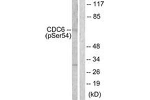 Western blot analysis of extracts from COS7 cells treated with EGF 200ng/ml 30', using CDC6 (Phospho-Ser54) Antibody. (CDC6 Antikörper  (pSer54))