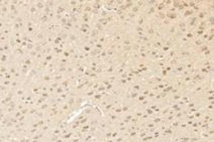 Immunohistochemistry analysis of paraffin-embedded mouse striatum using,RHOBTB3 (ABIN7075422) at dilution of 1: 3600 (RHOBTB3 Antikörper)