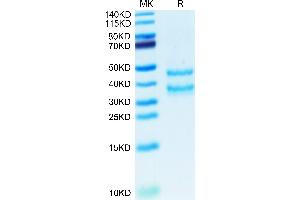 PKLR Protein (AA 20-105) (Fc Tag)