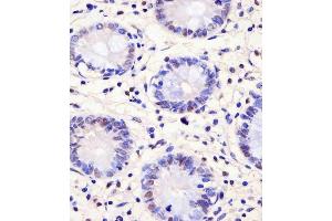 IHC-P analysis of human colon tissue. (PELP1 Antikörper)