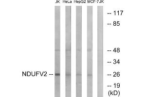Western blot analysis of extracts from Jurkat cells, HeLa cells, HepG2 cells and MCF-7 cells, using NDUFV2 antibody. (NDUFV2 Antikörper  (Internal Region))