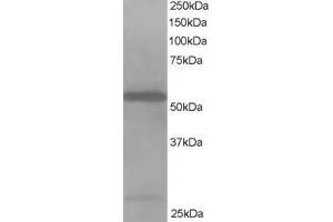 Western Blotting (WB) image for anti-Drebrin-Like (DBNL) antibody (ABIN5900113) (DBNL Antikörper)
