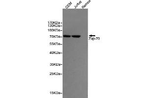 Western blot detection of Z70 in CEM and Jurkat cell lysates,negative in the Ramos cell lysates using Z70 mouse mAb (1:1000 diluted). (ZAP70 Antikörper)