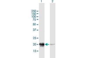 Western Blot analysis of PDC expression in transfected 293T cell line by PDC MaxPab polyclonal antibody. (Phosducin Antikörper  (AA 1-194))