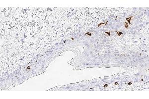 Immunohistochemistry (IHC) image for anti-CD207 Molecule, Langerin (CD207) antibody (ABIN7538905) (CD207 Antikörper)