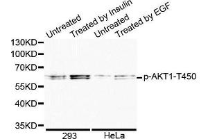 Western blot analysis of extracts of various cell lines, using Phospho-AKT1-T450 antibody. (AKT1 Antikörper  (pThr450))