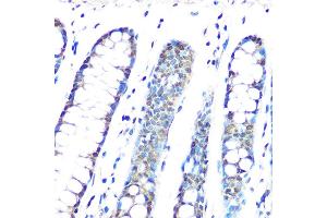 Immunohistochemistry of paraffin-embedded human colon using HP1 gamma/CBX3 Rabbit mAb (ABIN1679484, ABIN3018775, ABIN3018776 and ABIN7101659) at dilution of 1:100 (40x lens). (CBX3 Antikörper)