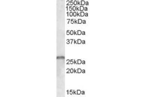 Image no. 1 for anti-SMN1 / SMN2 (all Isoforms), (Internal Region) antibody (ABIN374850) (SMN1 / SMN2 (all Isoforms), (Internal Region) Antikörper)