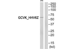 Western blot analysis of extracts from 3T3cells, using MAP2K3 antibody. (MAP2K3 Antikörper  (N-Term))