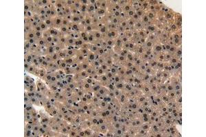 IHC-P analysis of liver tissue, with DAB staining. (Midkine Antikörper  (AA 22-140))