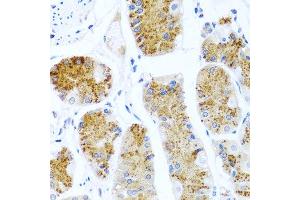 Immunohistochemistry of paraffin-embedded human stomach using C8orf4 antibody at dilution of 1:100 (40x lens). (C8orf4 Antikörper)