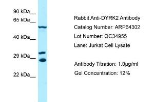 Western Blotting (WB) image for anti-Dual-Specificity tyrosine-(Y)-phosphorylation Regulated Kinase 2 (DYRK2) (C-Term) antibody (ABIN970575) (DYRK2 Antikörper  (C-Term))