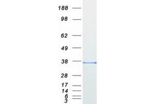 FHL1 Protein (Myc-DYKDDDDK Tag)